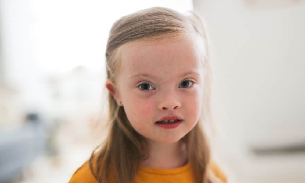 How To Help Your Child With Down Syndrome Cope With Anxiety